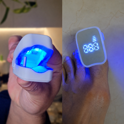 Laser Para Quitar Hongos De Las Uñas. (Onicomicosis)
